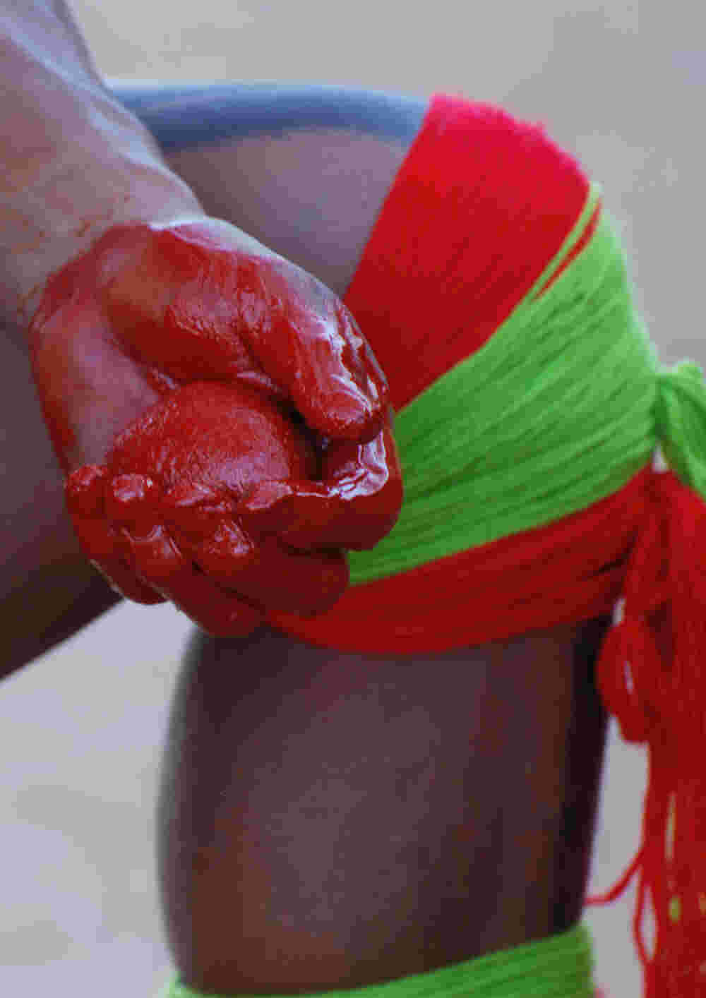 menschliches Knie mit rot-grüner Schliefe und Hand mit roter Farbe gefärbt